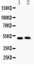 Anti-Aquaporin 0 Rabbit Polyclonal Antibody