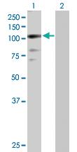 Anti-ZNF274 Rabbit Polyclonal Antibody