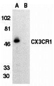 Western blot analysis of CX3CR1 in THP-1 cell lysate in the absence (lane A) or presence (lane B) of blocking peptide (2201P) with CX3CR1 antibody at 1:500 dilution.