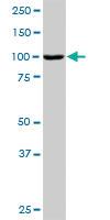 Anti-PBXIP1 Mouse Polyclonal Antibody