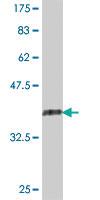 Anti-RAB32 Mouse Polyclonal Antibody