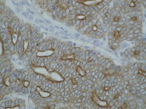 Detection of cytokeratin on paraffin-embedded sections of guinea pig breast carcinoma using Anti-Cytokeratin (Pan Reactive) Antibody (A86447)