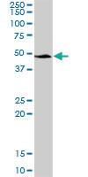 Anti-SERPINA3 Mouse Polyclonal Antibody