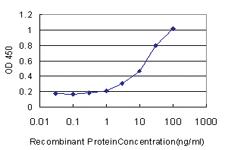 Anti-MDH2 Mouse Monoclonal Antibody [clone: 2A7]