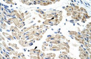 Anti-HNRNPK Rabbit Polyclonal Antibody