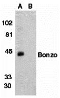 Western blot analysis of Bonzo in human spleen tissue lysate in the absence (lane A) or presence (lane B) of peptide (2209P) with Bonzo antibody (NT2) at 1:500 dilution.