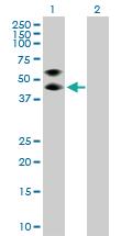 Anti-SERPINA3 Mouse Polyclonal Antibody