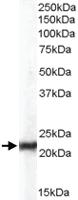 Anti-CBX5 Goat Polyclonal Antibody