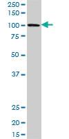 Anti-PBXIP1 Mouse Polyclonal Antibody