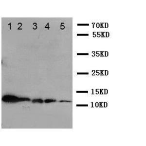 Anti-Macrophage Inflammatory Protein 1 beta Rabbit Polyclonal Antibody