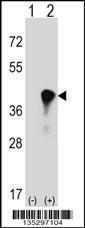 Anti-C4BPB Rabbit Polyclonal Antibody (HRP (Horseradish Peroxidase))