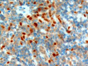 Anti-NET1 Antibody (A82953) (1µg/ml) staining of paraffin embedded Human Tonsil. Microwaved antigen retrieval with citrate buffer pH 6, HRP-staining.