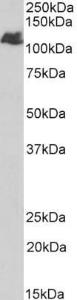 Anti-BMPR2 Antibody (A84568) (1 µg/ml) staining of Human Liver lysate (35 µg protein in RIPA buffer). Primary incubation was 1 hour. Detected by chemiluminescence