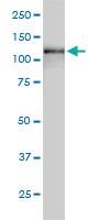 Anti-USP15 Mouse Monoclonal Antibody [clone: 1C10]