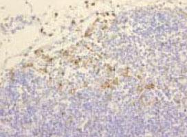 Anti-Macrophage surface Antigen Mouse Monoclonal Antibody [clone: AM-3K]