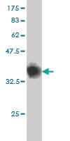 Anti-GABBR1 Mouse Monoclonal Antibody [clone: 2D7]