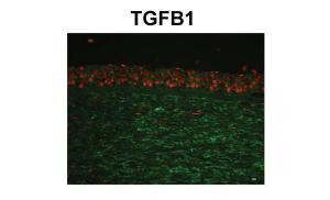 Anti-TGFBI Rabbit Polyclonal Antibody