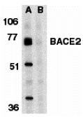 Western blot analysis of BACE2 in human heart tissue lysate in the absence (A) or presence (B) of blocking peptide (2249P) with BACE2 antibody at 1 &#956;g/mL.