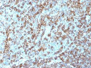 Anti-HLA DRB Mouse Monoclonal Antibody [clone: LN-3]