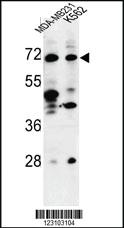 Anti-TSPEAR Rabbit Polyclonal Antibody