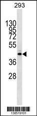 Anti-METTL2B Rabbit Polyclonal Antibody (AP (Alkaline Phosphatase))