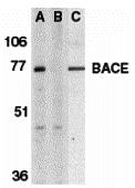 Western blot analysis of BACE in human brain tissue lysate in the absence (A) or presence (B) of blocking peptide (2253P) and in mouse 3T3 cell lysate (C) with BACE antibody at 1 &#956;g/mL.