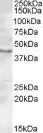 Anti-LASS3 Antibody (A84569) (0.2 µg/ml) staining of Rat Testis lysate (35 µg protein in RIPA buffer). Primary incubation was 1 hour. Detected by chemiluminescence