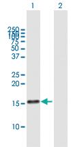 Anti-MDK Mouse Polyclonal Antibody