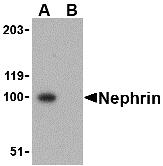 Western blot analysis of Nephrin in mouse kidney tissue lysate with Nephrin antibody at 1 &#956;g/mL in the (A) absence and (B) presence of blocking peptide (2265P).