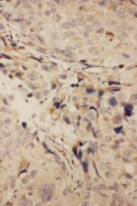 Anti-RANK Rabbit Polyclonal Antibody