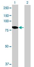 Anti-DMPK Mouse Polyclonal Antibody