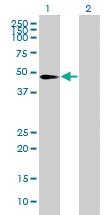 Anti-PYGO1 Mouse Polyclonal Antibody