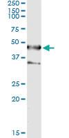 Anti-SEPT1 Antibody Pair