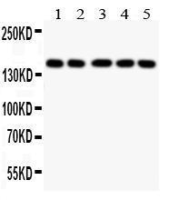 Anti-Collagen II Rabbit Antibody