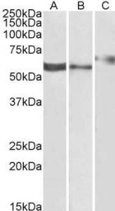 Anti-P2RX4 Antibody (A84570) (1 µg/ml) staining of Human Kidney (A), Human Liver (B) and Rat Kidney (C) lysate (35 µg protein in RIPA buffer). Primary incubation was 1 hour. Detected by chemiluminescence