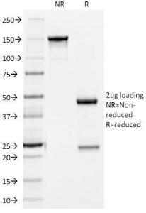 Anti-NCAM1 Mouse Monoclonal Antibody [clone: 123A8]