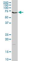 Anti-DMPK Rabbit Polyclonal Antibody