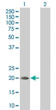 Anti-SNX24 Mouse Polyclonal Antibody