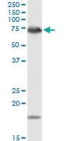 Anti-DMPK Rabbit Polyclonal Antibody