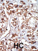 Anti-EIF2AK1 Rabbit Polyclonal Antibody (HRP (Horseradish Peroxidase))