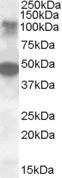 Anti-STK11IP Antibody (A84572) (0.5µg/ml) staining of Human Ovary lysate (35µg protein in RIPA buffer). Primary incubation was 1 hour. Detected by chemiluminescence.