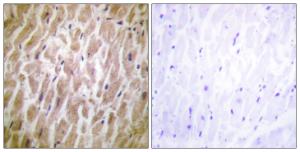 Immunohistochemical analysis of paraffin-embedded human heart tissue using Anti-MAPKAPK2 Antibody. The right hand panel represents a negative control, where the antibody was pre-incubated with the immunising peptide