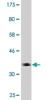 Anti-EXOSC4 Mouse Monoclonal Antibody [clone: 4F10]