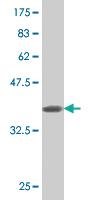 Anti-ASAH1 Mouse Monoclonal Antibody [clone: 1A7]