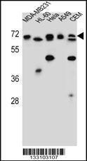 Anti-ASMTL Rabbit Polyclonal Antibody (PE (Phycoerythrin))