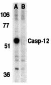 Western blot analysis of caspase-12 in mouse brain tissue lysate in the absence (A) or presence (B) of blocking peptide (2327P) with caspase-12 antibody (IN) at 1 &#956;g/mL.