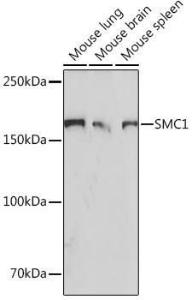 Western blot analysis of extracts of various cell lines, using Anti-SMC1A Antibody [ARC1095] (A308993) at 1:1000 dilution. The secondary Antibody was Goat Anti-Rabbit IgG H&L Antibody (HRP) at 1:10000 dilution. Lysates/proteins were present at 25 µg per lane