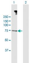 Anti-DMPK Rabbit Polyclonal Antibody