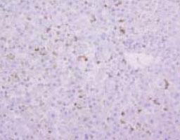 Anti-Macrophage surface Antigen Mouse Monoclonal Antibody [clone: AM-3K]