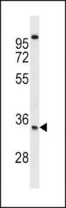 Anti-SOST Rabbit Polyclonal Antibody (HRP (Horseradish Peroxidase))